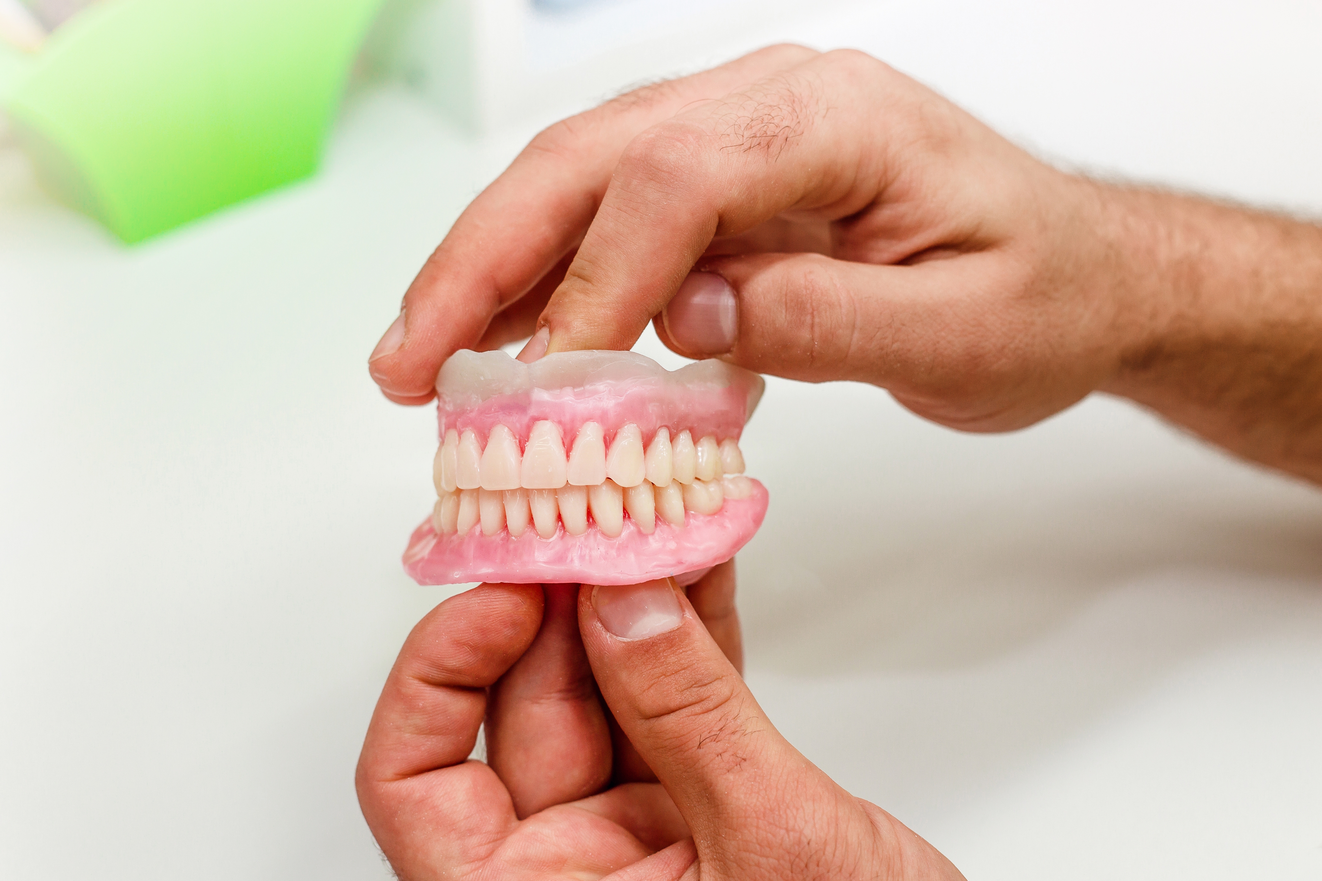 RPD (Removable Partial Denture)