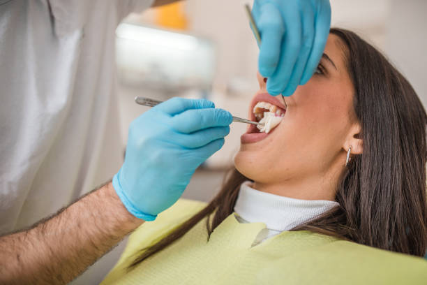 Impaction (Horizontal)